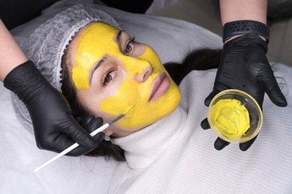Yellow Peel