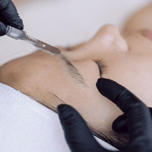 Dermaplaning
